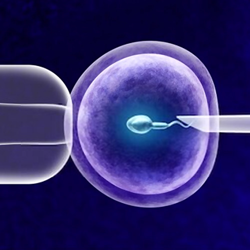 IVF Process